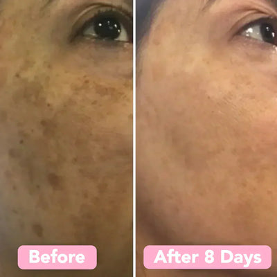 FrischAura™ Strahlende Glow-Reinigung